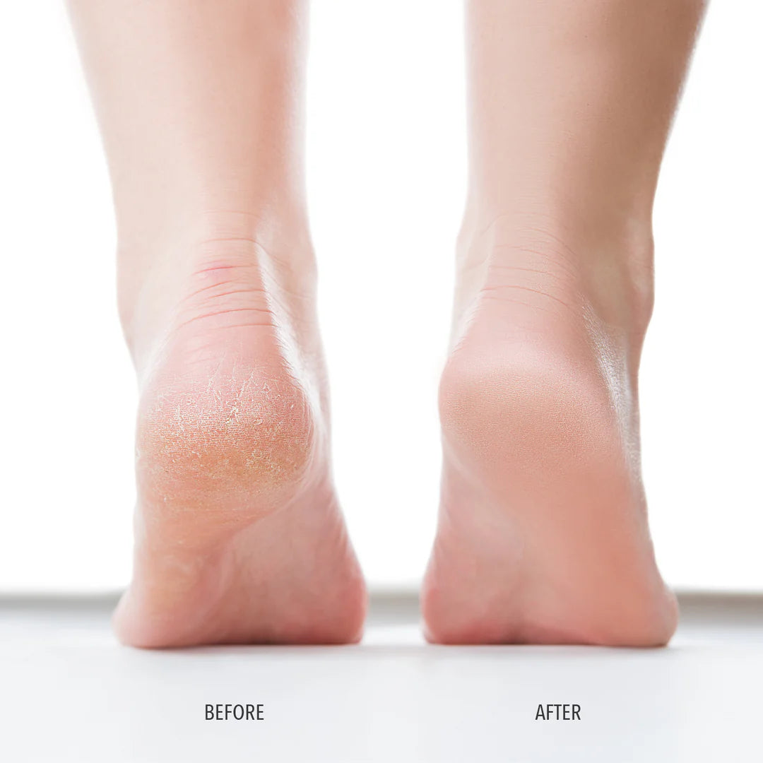 FEET SCRUB