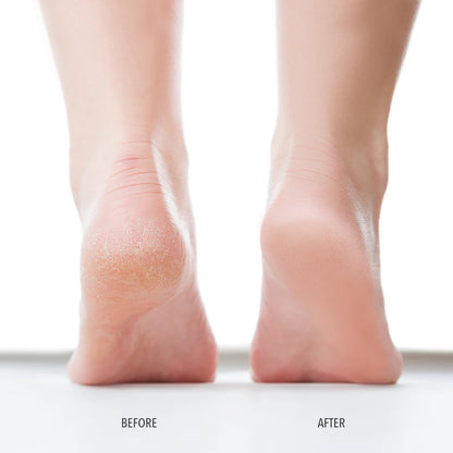 FEET SCRUB